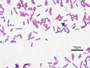 bacterie-infectie; tonsillitis