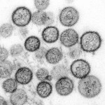 virusinfectie; tonsillitis